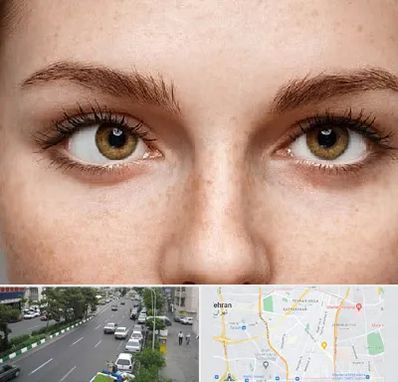 متخصص انحراف چشم در ستارخان 