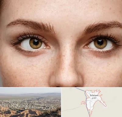 متخصص انحراف چشم در اسفراین