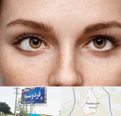 متخصص انحراف چشم در فردوسیه شهریار