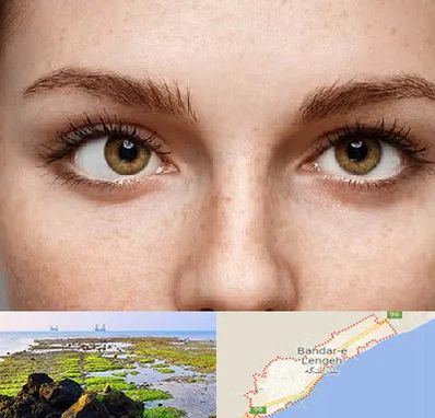 متخصص انحراف چشم در بندرلنگه