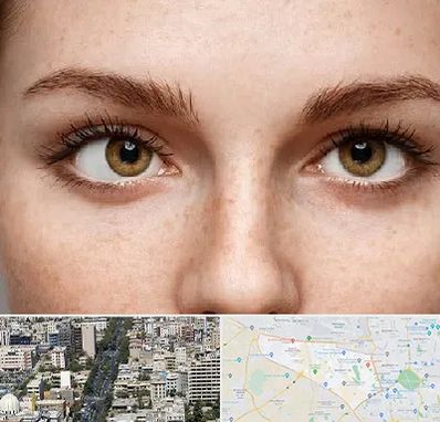 متخصص انحراف چشم در منطقه 18 تهران 