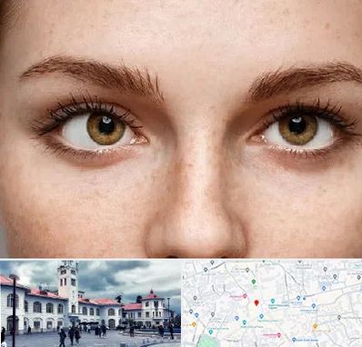 متخصص انحراف چشم در میدان شهرداری رشت