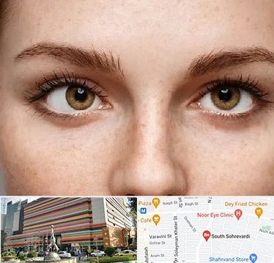 متخصص انحراف چشم در سهروردی 