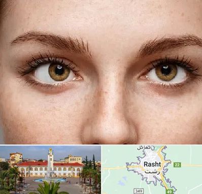 متخصص انحراف چشم در رشت