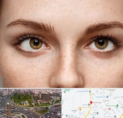 متخصص انحراف چشم در سبلان 