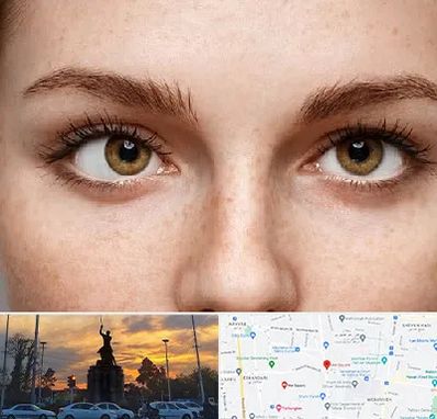 متخصص انحراف چشم در میدان حر 