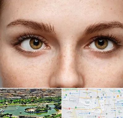 متخصص انحراف چشم در منطقه 9 تهران 