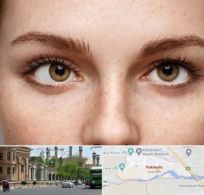 متخصص انحراف چشم در پاکدشت