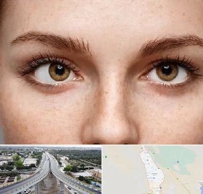 متخصص انحراف چشم در اندیمشک