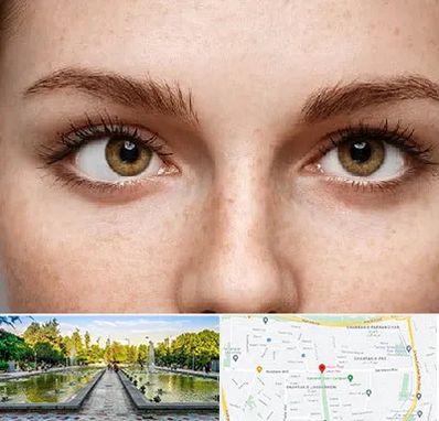 متخصص انحراف چشم در سرسبز 