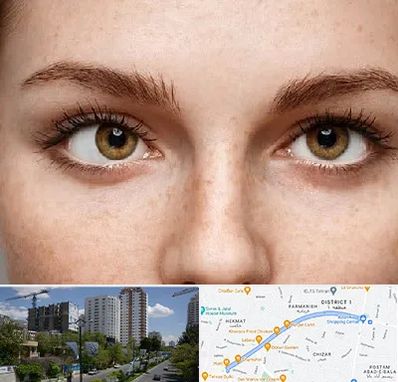 متخصص انحراف چشم در اندرزگو