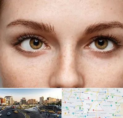 متخصص انحراف چشم در منطقه 7 تهران 