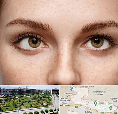 متخصص انحراف چشم در پردیس