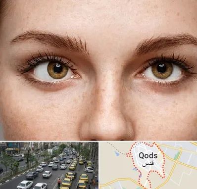 متخصص انحراف چشم در شهر قدس