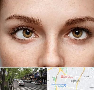 متخصص انحراف چشم در ظفر 