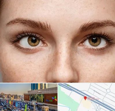 متخصص انحراف چشم در لاله پارک تبریز