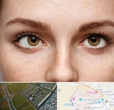 متخصص انحراف چشم در الهیه مشهد