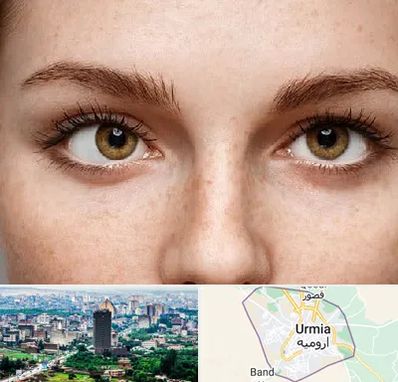 متخصص انحراف چشم در ارومیه