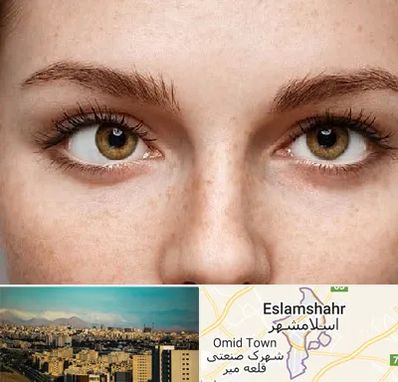 متخصص انحراف چشم در اسلامشهر