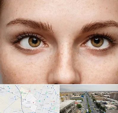 متخصص انحراف چشم در حصارک کرج