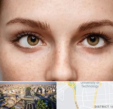 متخصص انحراف چشم در استاد معین 