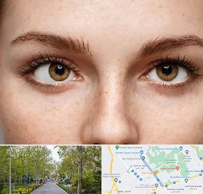 متخصص انحراف چشم در قدوسی غربی شیراز