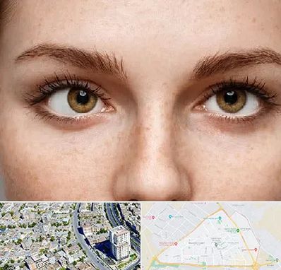 متخصص انحراف چشم در قاسم آباد مشهد 