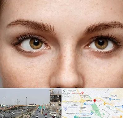 متخصص انحراف چشم در بلوار توس مشهد 