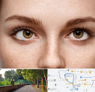 متخصص انحراف چشم در بلوار گیلان رشت