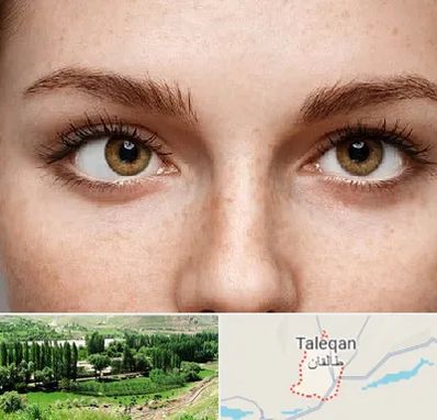 متخصص انحراف چشم در طالقان