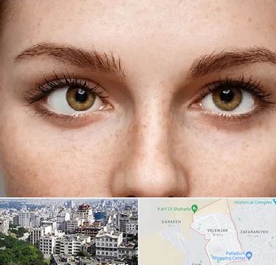 متخصص انحراف چشم در ولنجک 