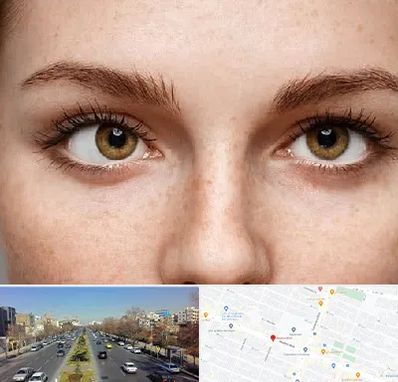 متخصص انحراف چشم در بلوار معلم مشهد 