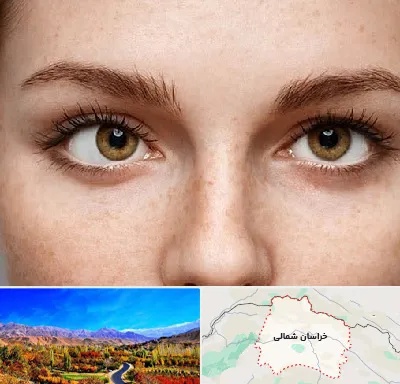 متخصص انحراف چشم در خراسان شمالی