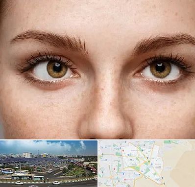 متخصص انحراف چشم در منطقه 15 تهران 