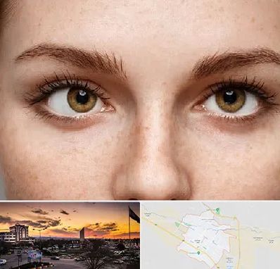 متخصص انحراف چشم در قوچان