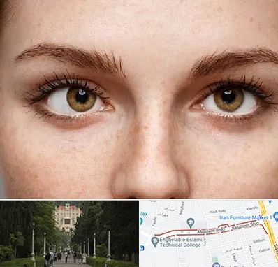 متخصص انحراف چشم در بلوار معلم رشت 