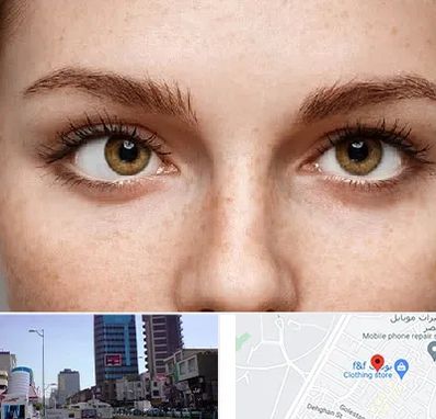 متخصص انحراف چشم در چهارراه طالقانی کرج