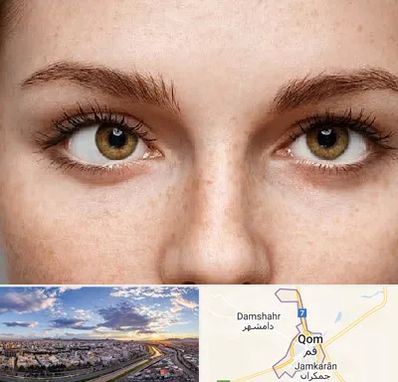 متخصص انحراف چشم در قم