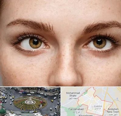 متخصص انحراف چشم در فردیس کرج 
