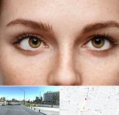 متخصص انحراف چشم در بلوار کلاهدوز مشهد 