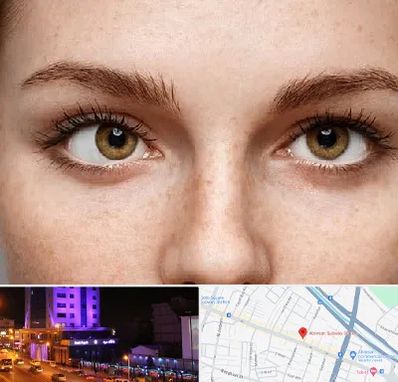 متخصص انحراف چشم در آبرسان تبریز