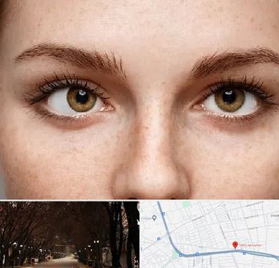 متخصص انحراف چشم در ابوریحان تبریز