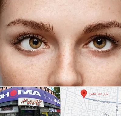 متخصص انحراف چشم در امین حضور