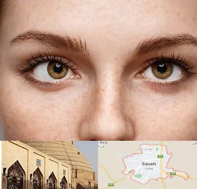 متخصص انحراف چشم در ساوه
