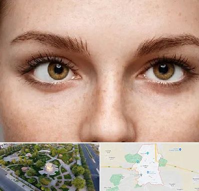 متخصص انحراف چشم در کاشمر