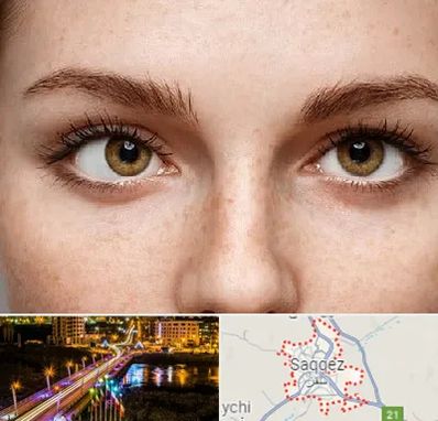 متخصص انحراف چشم در سقز