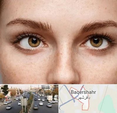 متخصص انحراف چشم در باقرشهر