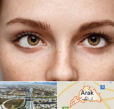 متخصص انحراف چشم در اراک