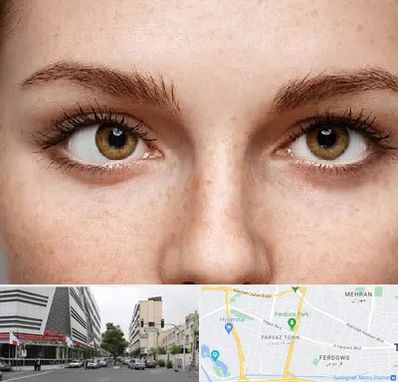 متخصص انحراف چشم در بلوار فردوس 