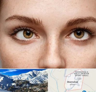 متخصص انحراف چشم در شمشک